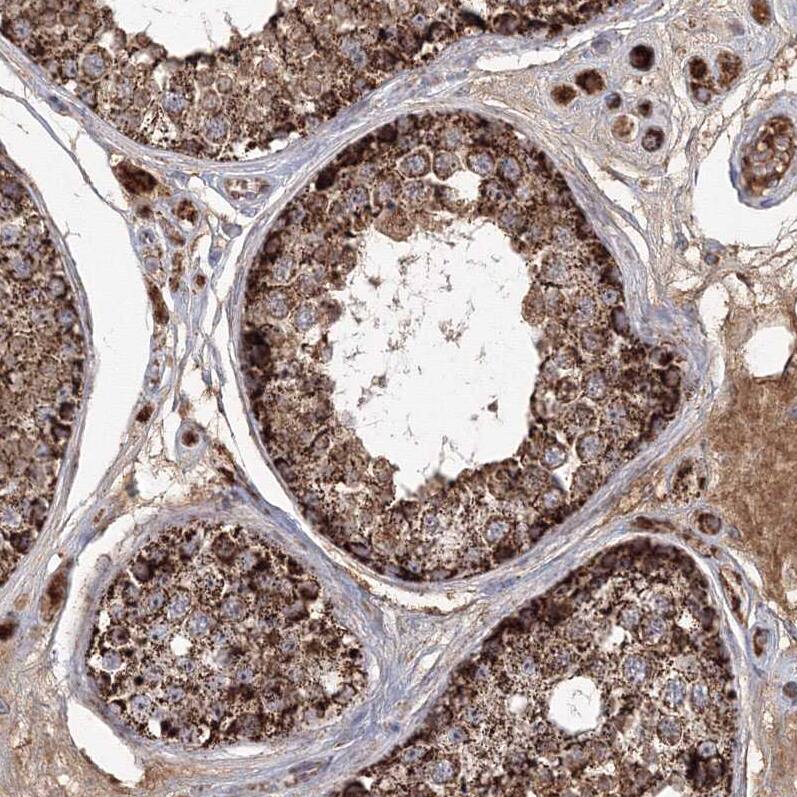 GRPEL1 Antibody - BSA Free Immunohistochemistry-Paraffin: GRPEL1 Antibody - BSA Free [NBP1-83557]