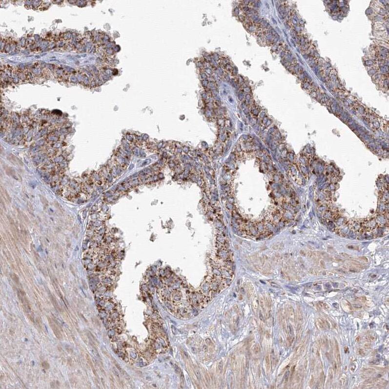 GRPEL1 Antibody - BSA Free Immunohistochemistry-Paraffin: GRPEL1 Antibody - BSA Free [NBP1-83557]