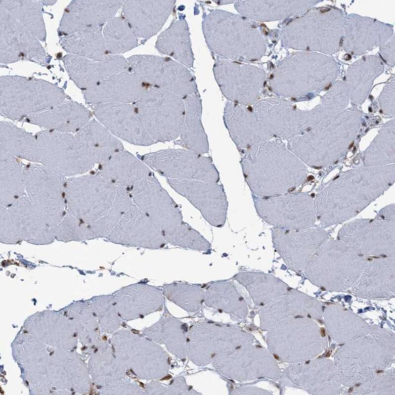 DDX46 Antibody - BSA Free Immunohistochemistry-Paraffin: DDX46 Antibody - BSA Free [NBP1-83565]