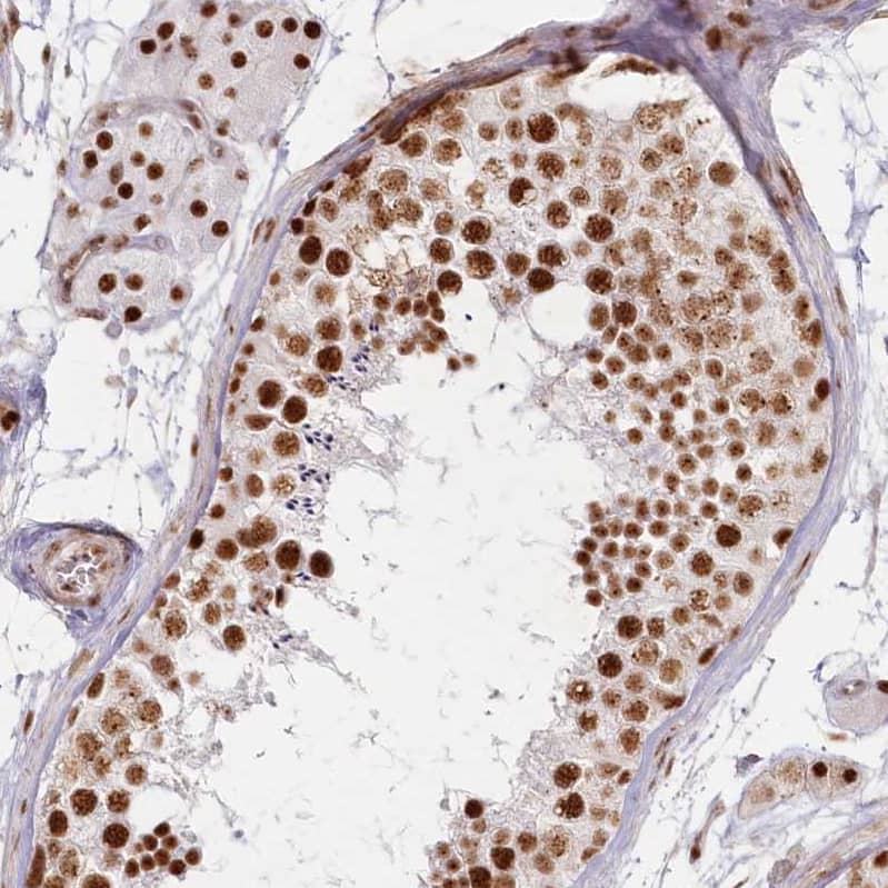 DDX46 Antibody - BSA Free Immunohistochemistry-Paraffin: DDX46 Antibody - BSA Free [NBP1-83565]