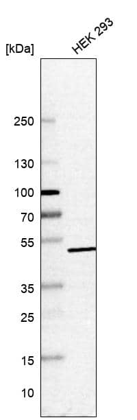 HEXDC Antibody - BSA Free Western Blot: HEXDC Antibody - BSA Free [NBP1-83575]