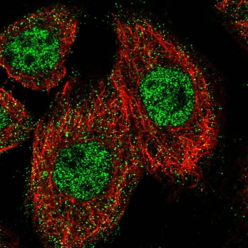 ZNF449 Antibody - BSA Free Immunocytochemistry/ Immunofluorescence: ZNF449 Antibody [NBP1-83580]