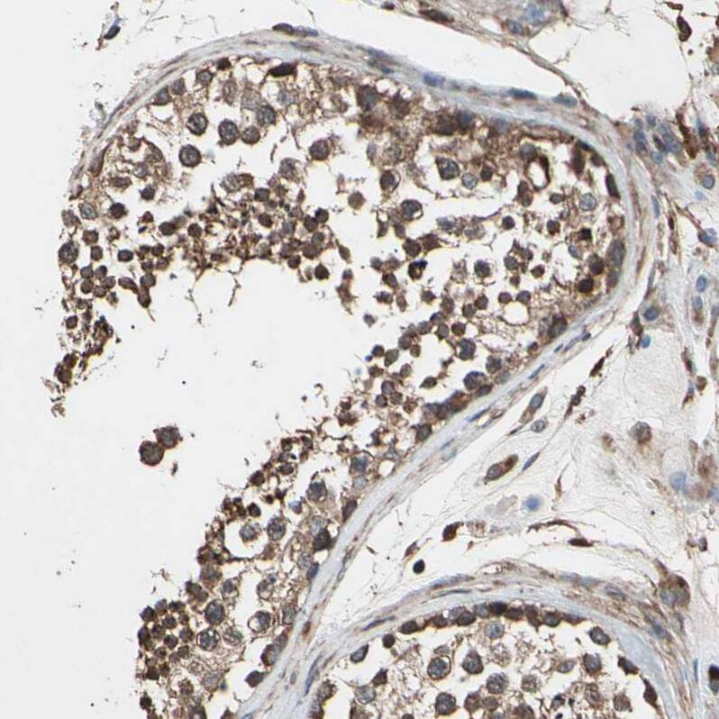 AGBL2 Antibody - BSA Free Immunohistochemistry-Paraffin: AGBL2 Antibody - BSA Free [NBP1-83581]