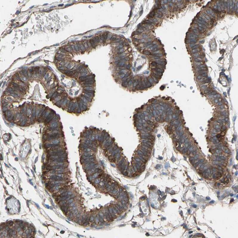 AGBL2 Antibody - BSA Free Immunohistochemistry-Paraffin: AGBL2 Antibody - BSA Free [NBP1-83581]