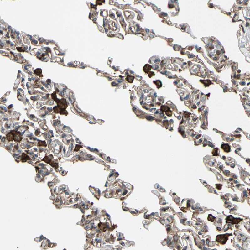 AGBL2 Antibody - BSA Free Immunohistochemistry-Paraffin: AGBL2 Antibody - BSA Free [NBP1-83581]