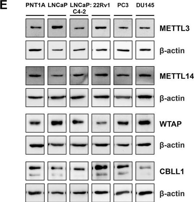 CBLL1 Antibody - BSA Free
