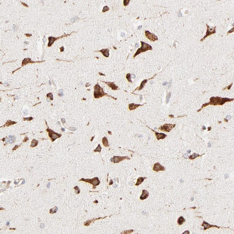 PARP12 Antibody - BSA Free Immunohistochemistry-Paraffin: PARP12 Antibody - BSA Free [NBP1-83592]