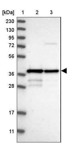 MRM1 Antibody - BSA Free Western Blot: MRM1 Antibody - BSA Free [NBP1-83597]