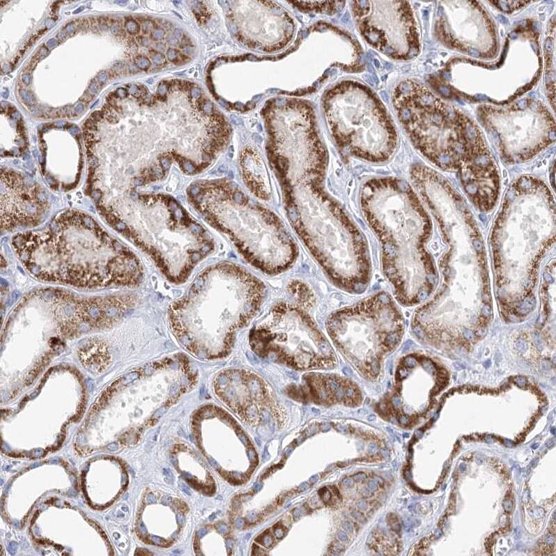 XPO6 Antibody - BSA Free Immunohistochemistry-Paraffin: XPO6 Antibody - BSA Free [NBP1-83601]