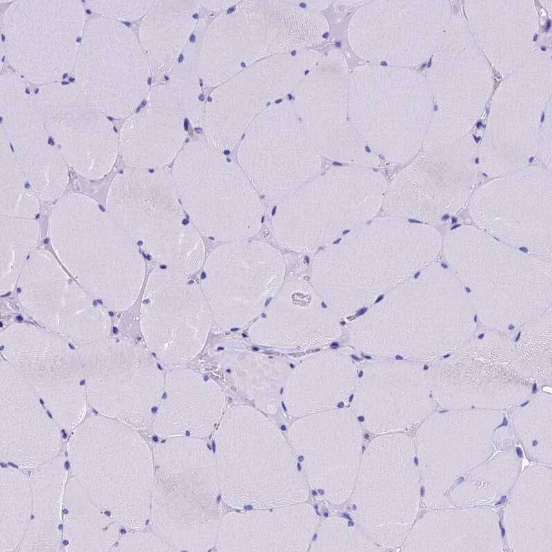 SLC24A6 Antibody - BSA Free Immunohistochemistry-Paraffin: SLC24A6 Antibody [NBP1-83607]