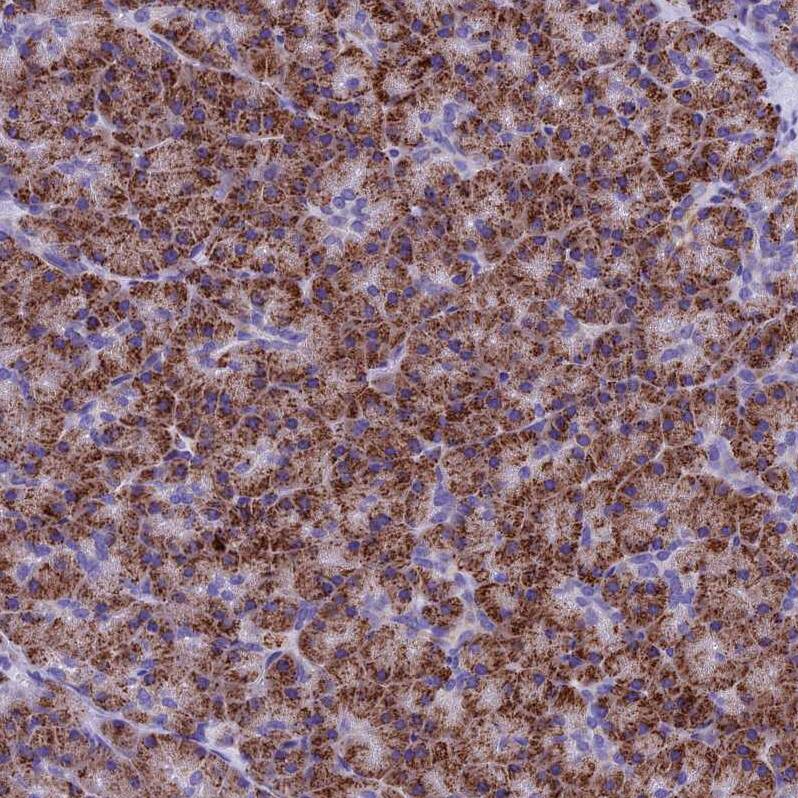 SLC24A6 Antibody - BSA Free Immunohistochemistry-Paraffin: SLC24A6 Antibody [NBP1-83607]