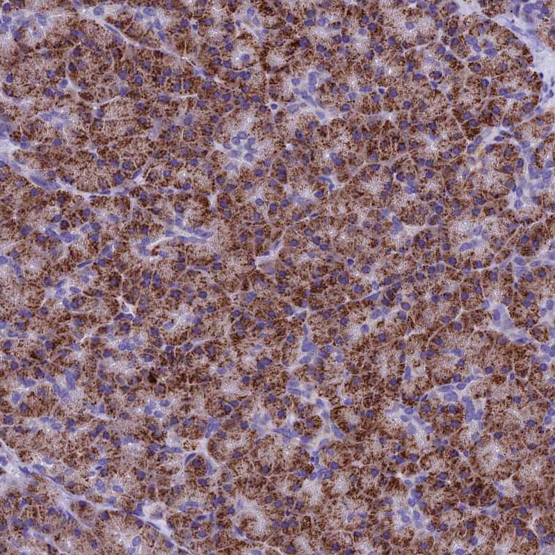SLC24A6 Antibody - BSA Free Immunohistochemistry-Paraffin: SLC24A6 Antibody - BSA Free [NBP1-83607]
