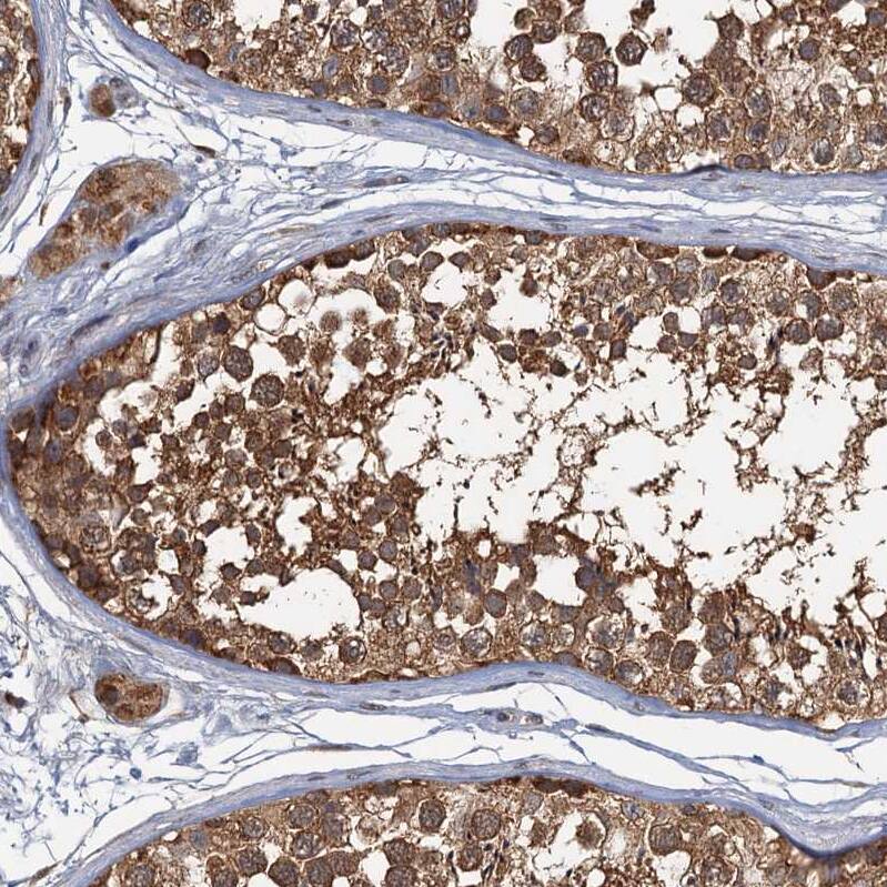 WDCP Antibody - BSA Free Immunohistochemistry-Paraffin: WDCP Antibody - BSA Free [NBP1-83612]