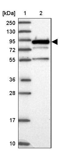 EPS8L2 Antibody - BSA Free Western Blot: EPS8L2 Antibody - BSA Free [NBP1-83613]