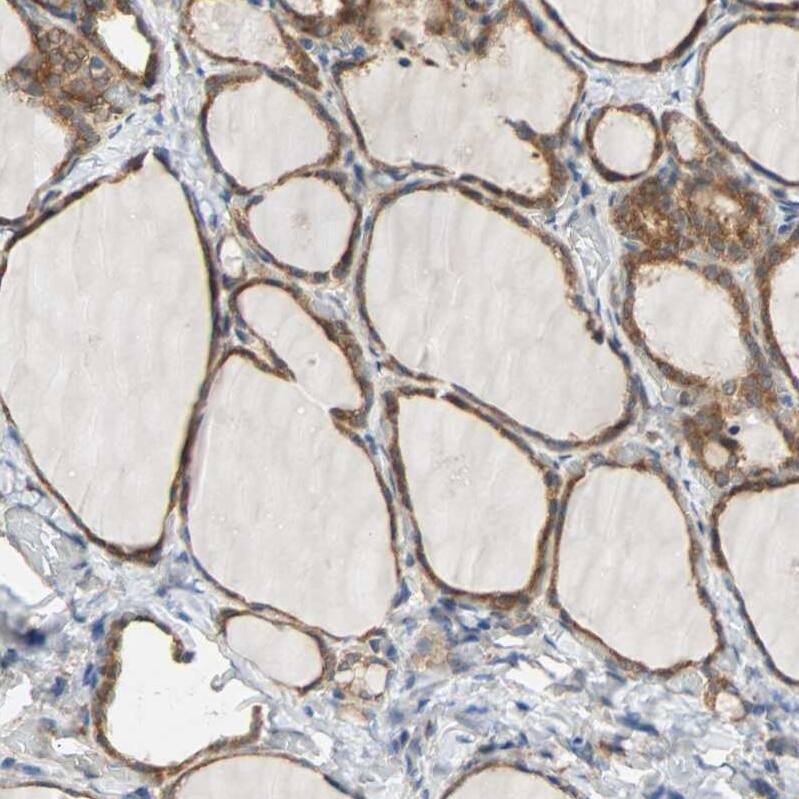 QSER1 Antibody - BSA Free Immunohistochemistry-Paraffin: QSER1 Antibody - BSA Free [NBP1-83614]