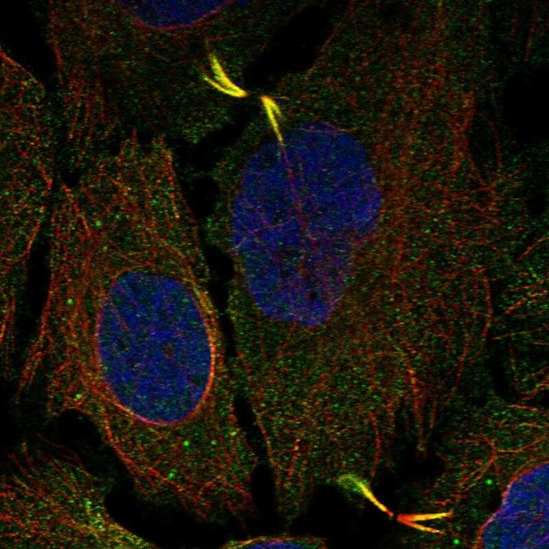 AGBL5 Antibody - BSA Free Immunocytochemistry/ Immunofluorescence: AGBL5 Antibody [NBP1-83616]