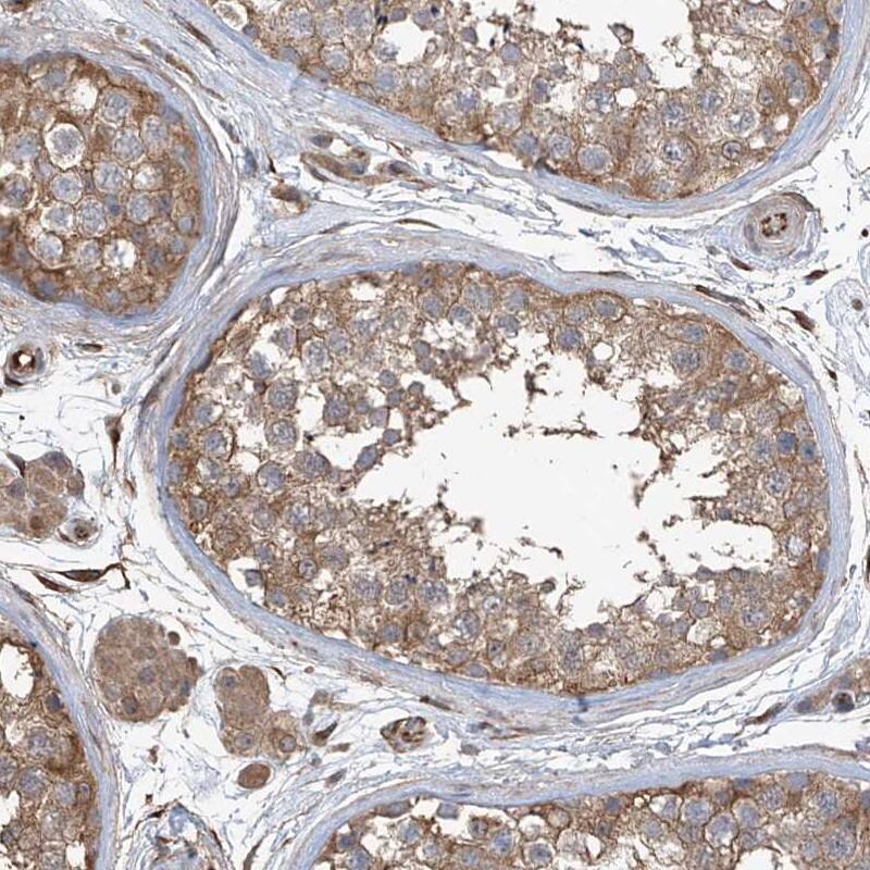 AGBL5 Antibody - BSA Free Immunohistochemistry-Paraffin: AGBL5 Antibody - BSA Free [NBP1-83616]