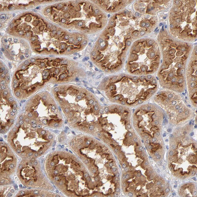 ASB8 Antibody - BSA Free Immunohistochemistry-Paraffin: ASB8 Antibody - BSA Free [NBP1-83620]