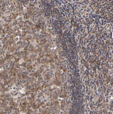 ASB8 Antibody ASB8 Antibody
