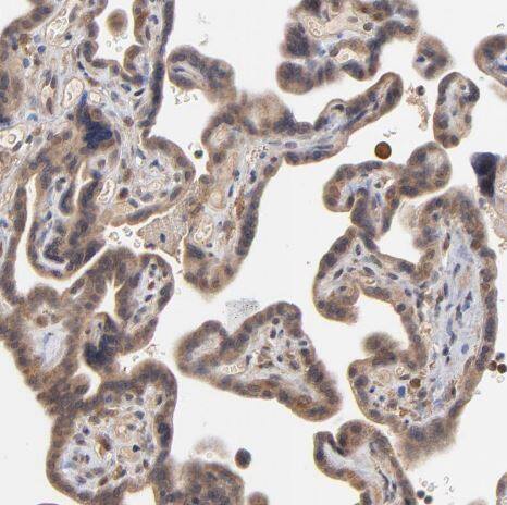 ASB8 Antibody ASB8 Antibody