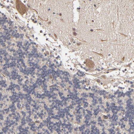 ASB8 Antibody ASB8 Antibody