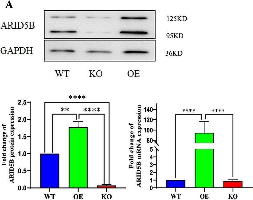 ARID5B Antibody - BSA Free