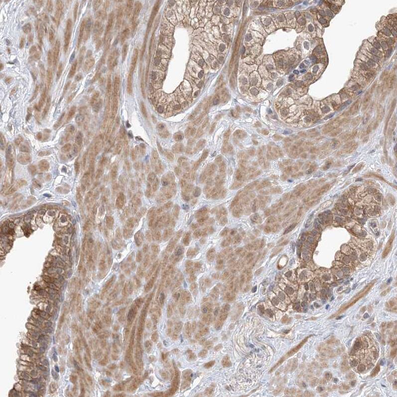 WDR26 Antibody - BSA Free Immunohistochemistry-Paraffin: WDR26 Antibody - BSA Free [NBP1-83628]