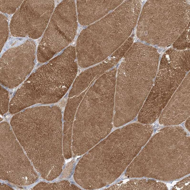 WDR26 Antibody - BSA Free Immunohistochemistry-Paraffin: WDR26 Antibody - BSA Free [NBP1-83628]