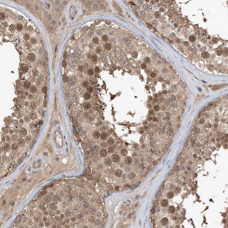 WDR26 Antibody - BSA Free Immunohistochemistry-Paraffin: WDR26 Antibody - BSA Free [NBP1-83628]