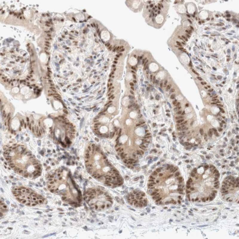 TRMT12 Antibody - BSA Free Immunohistochemistry-Paraffin: TRMT12 Antibody - BSA Free [NBP1-83633]