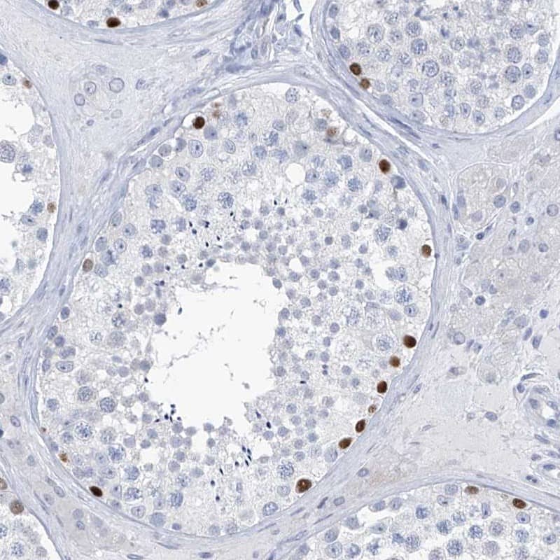 SLC35A5 Antibody - BSA Free Immunohistochemistry-Paraffin: SLC35A5 Antibody [NBP1-83636]