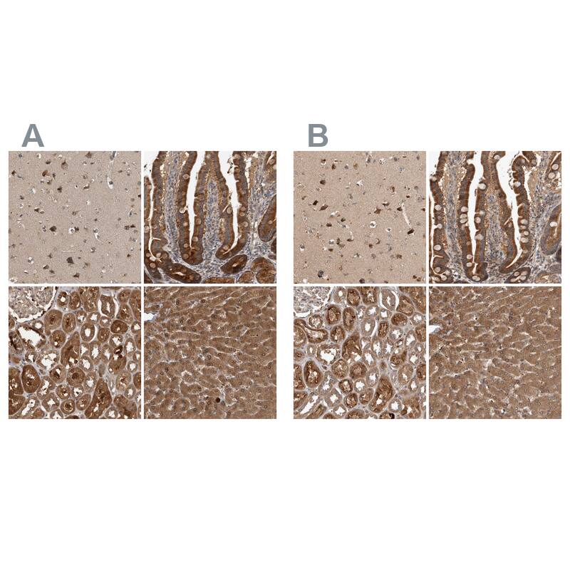 TRMT61B Antibody Immunohistochemistry-Paraffin: TRMT61B Antibody Antibody [NBP1-83640]