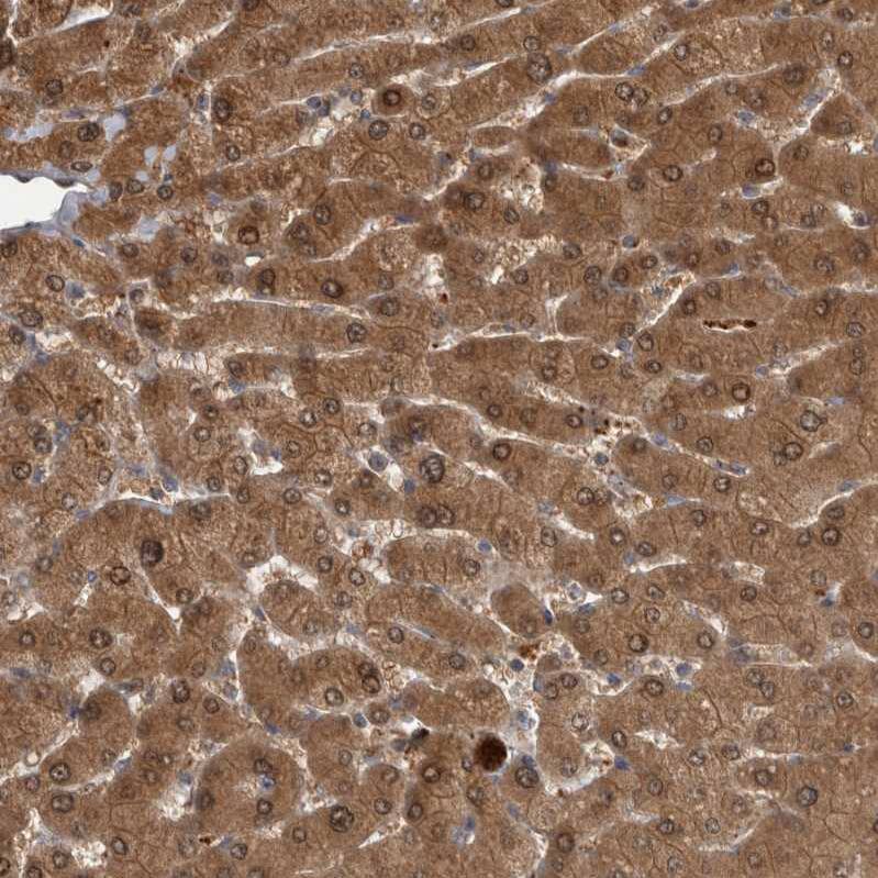 TRMT61B Antibody - BSA Free Immunohistochemistry-Paraffin: TRMT61B Antibody - BSA Free [NBP1-83640]