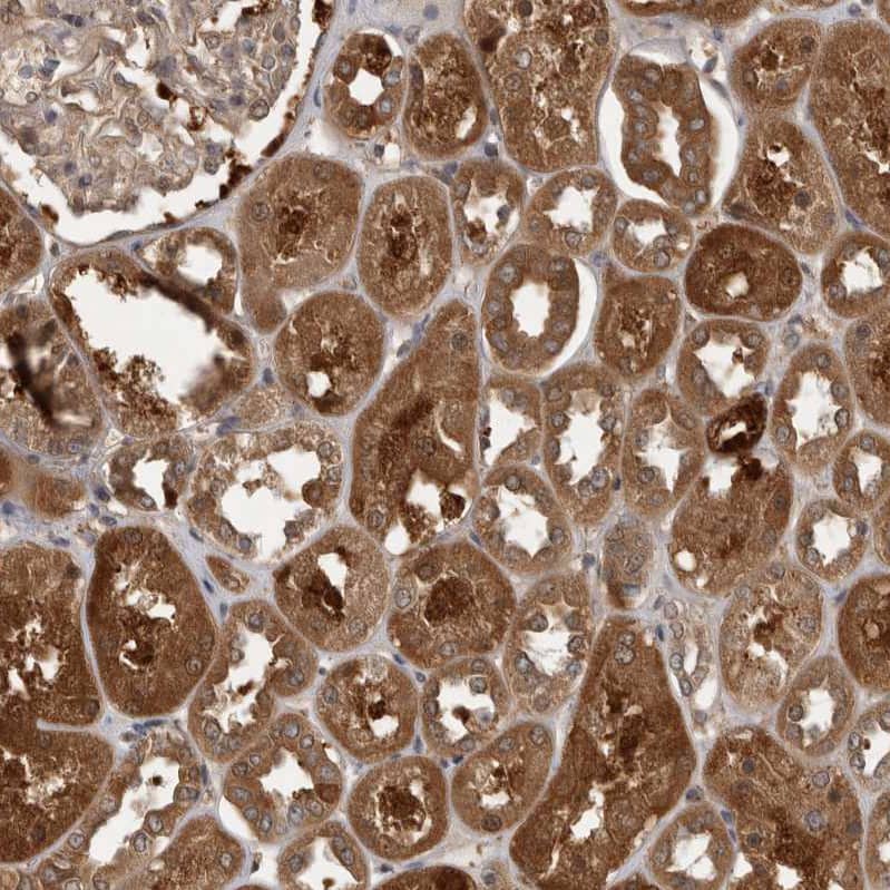 TRMT61B Antibody - BSA Free Immunohistochemistry-Paraffin: TRMT61B Antibody - BSA Free [NBP1-83640]