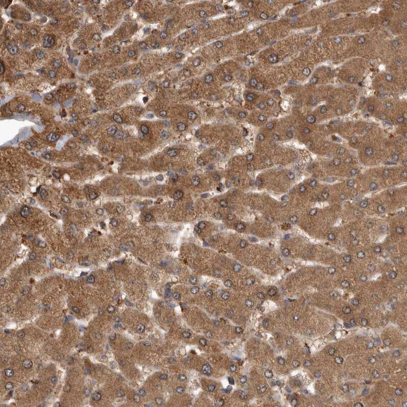 TRMT61B Antibody - BSA Free Immunohistochemistry-Paraffin: TRMT61B Antibody - BSA Free [NBP1-83641]