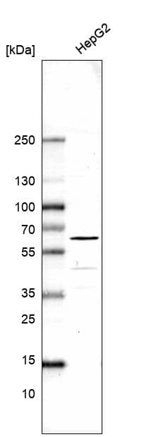 TRMT61B Antibody - BSA Free Western Blot: TRMT61B Antibody - BSA Free [NBP1-83641]
