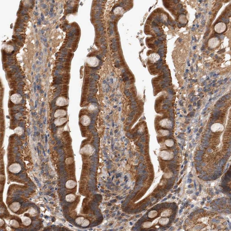 TRMT61B Antibody - BSA Free Immunohistochemistry-Paraffin: TRMT61B Antibody - BSA Free [NBP1-83641]