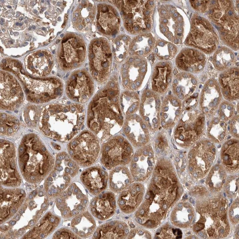 TRMT61B Antibody - BSA Free Immunohistochemistry-Paraffin: TRMT61B Antibody - BSA Free [NBP1-83641]