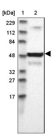 UCKL1 Antibody - BSA Free Western Blot: UCKL1 Antibody - BSA Free [NBP1-83649]