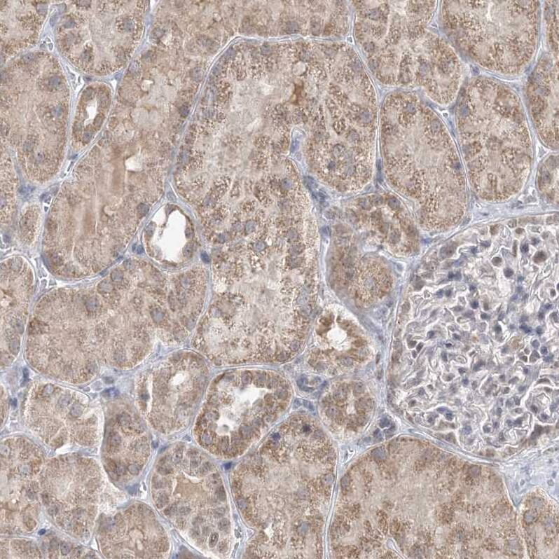 RG9MTD1 Antibody - BSA Free Immunohistochemistry-Paraffin: RG9MTD1 Antibody - BSA Free [NBP1-83654]