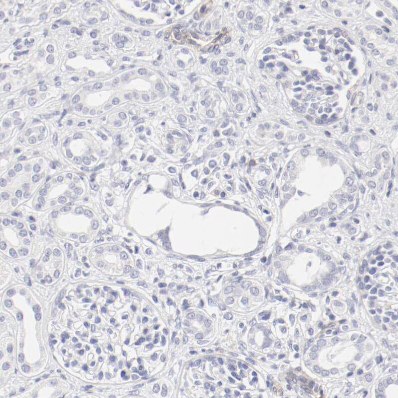 LAX1 Antibody - BSA Free Immunohistochemistry-Paraffin: LAX1 Antibody - BSA Free [NBP1-83661]