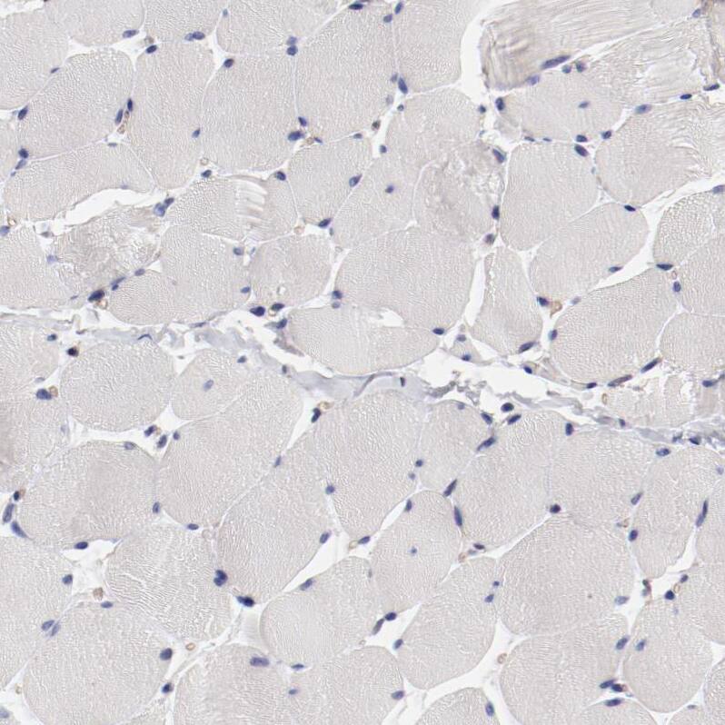 LAX1 Antibody - BSA Free Immunohistochemistry-Paraffin: LAX1 Antibody - BSA Free [NBP1-83661]
