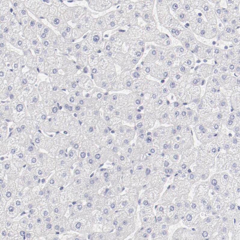 LAX1 Antibody - BSA Free Immunohistochemistry-Paraffin: LAX1 Antibody - BSA Free [NBP1-83661]