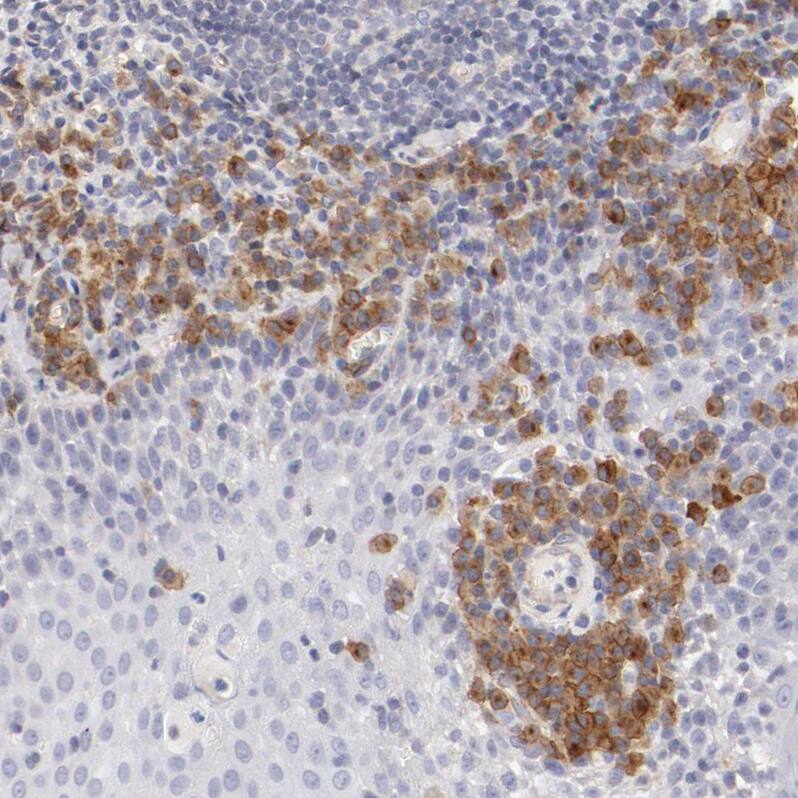 LAX1 Antibody - BSA Free Immunohistochemistry-Paraffin: LAX1 Antibody - BSA Free [NBP1-83661]