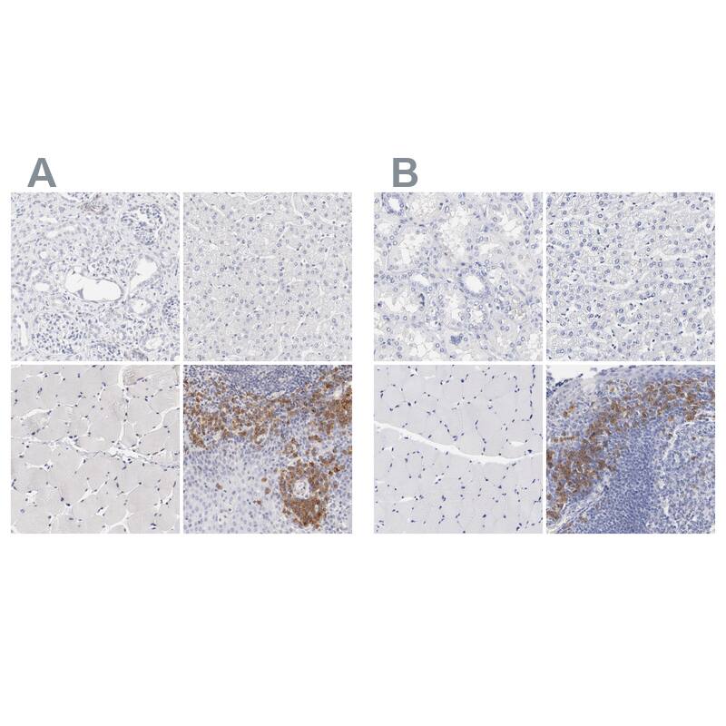 LAX1 Antibody - BSA Free Immunohistochemistry-Paraffin: LAX1 Antibody - BSA Free [NBP1-83661]