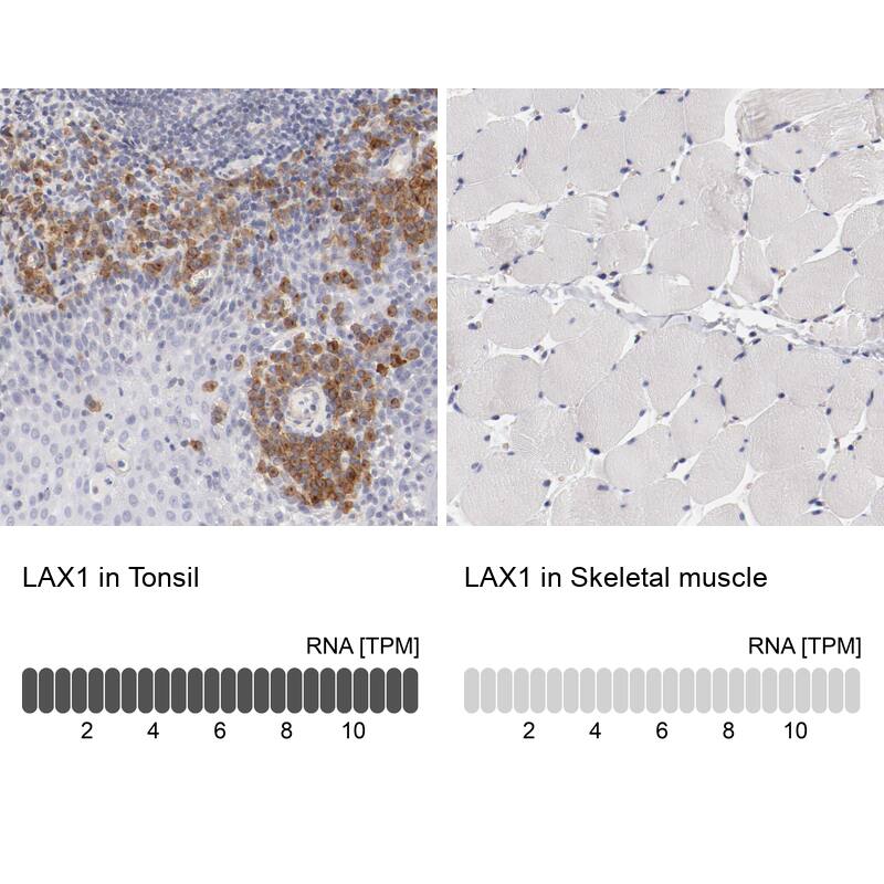 LAX1 Antibody - BSA Free Immunohistochemistry-Paraffin: LAX1 Antibody - BSA Free [NBP1-83661]