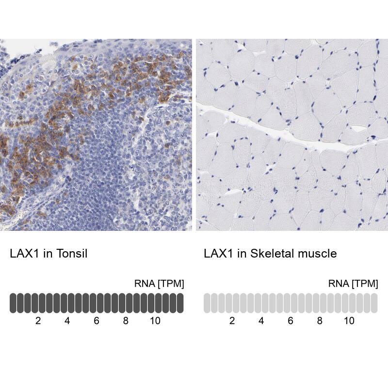 LAX1 Antibody - BSA Free Immunohistochemistry-Paraffin: LAX1 Antibody - BSA Free [NBP1-83662]
