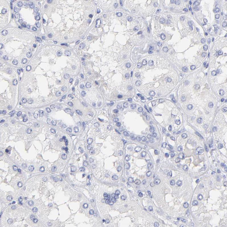 LAX1 Antibody - BSA Free Immunohistochemistry-Paraffin: LAX1 Antibody - BSA Free [NBP1-83662]