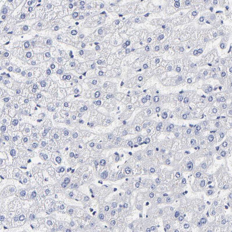 LAX1 Antibody - BSA Free Immunohistochemistry-Paraffin: LAX1 Antibody - BSA Free [NBP1-83662]