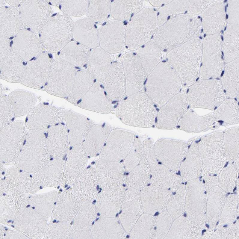 LAX1 Antibody - BSA Free Immunohistochemistry-Paraffin: LAX1 Antibody - BSA Free [NBP1-83662]